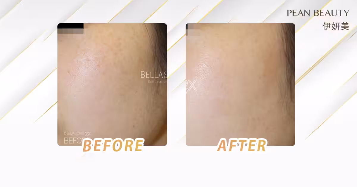 Bellasonic水光槍 compare_3